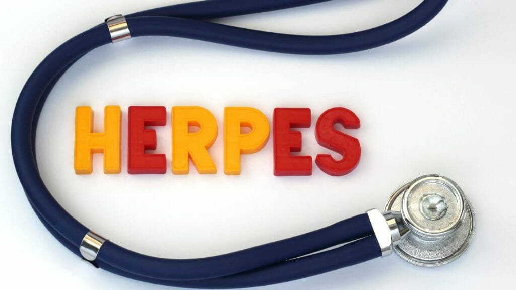 Berapa Lama Herpes Kelamin Sembuh 1024x576