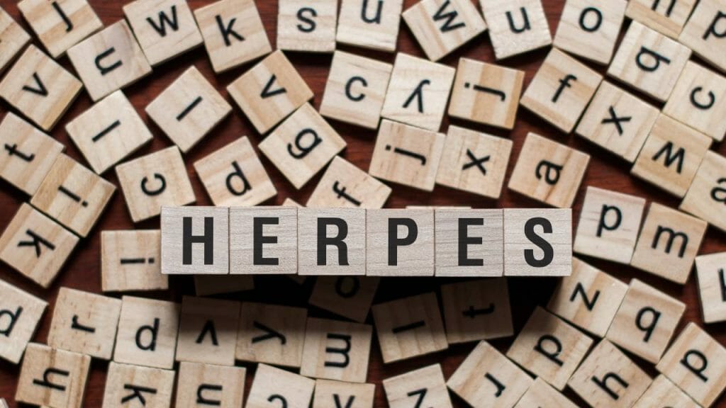Cara Pengobatan Herpes Kelamin 2 1024x576
