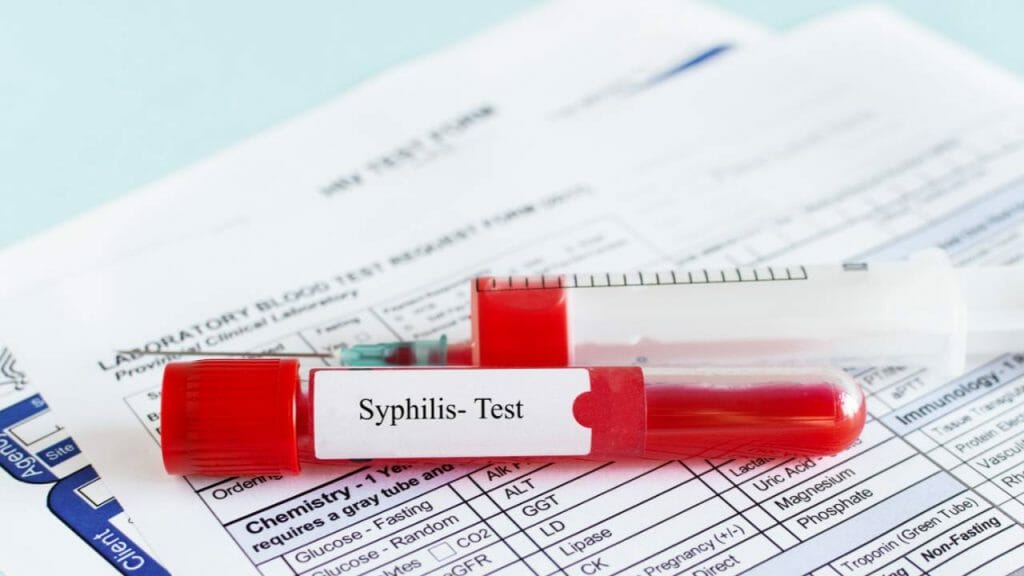Prosedur Pemeriksaan Serologi Untuk Deteksi Sifilis 1024x576