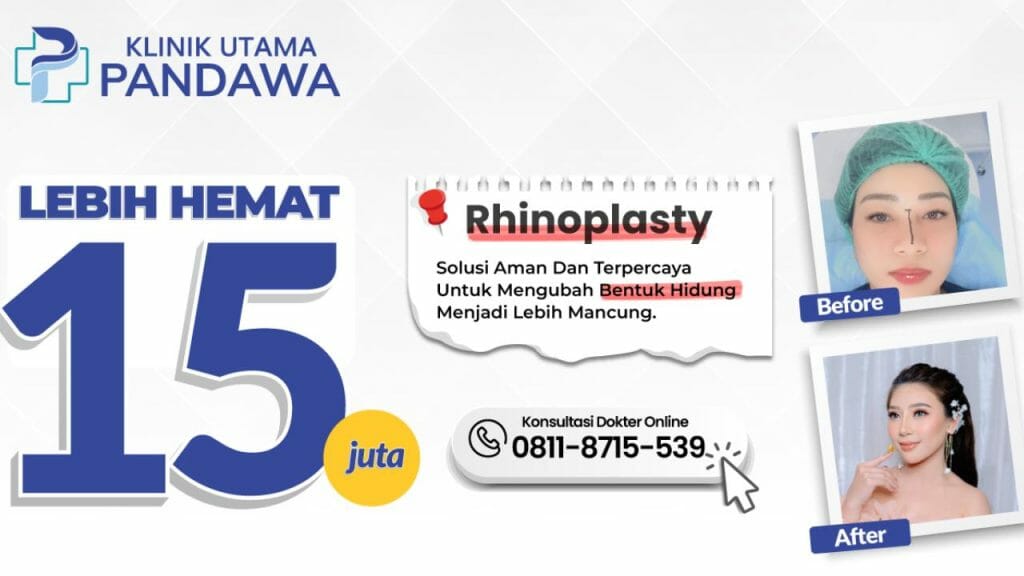 Before After Rhinoplasty Dan Promo Di Klinik Utama Pandawa Jakarta 1024x576