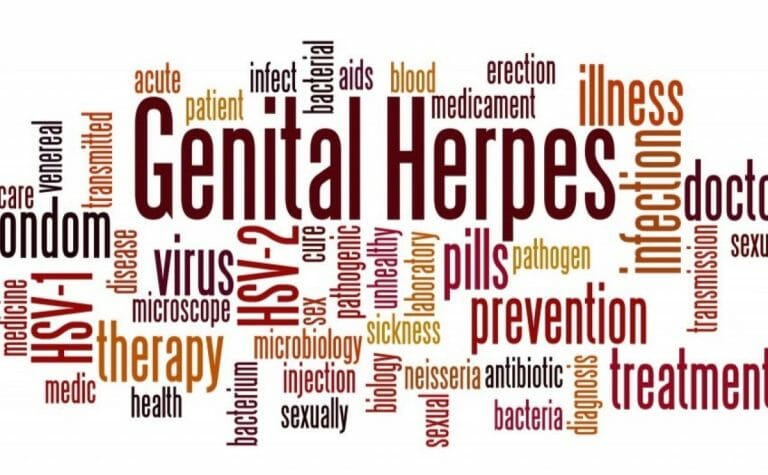 ciri ciri herpes genital akan sembuh