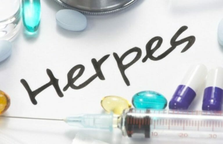 Penyebab Herpes Genital